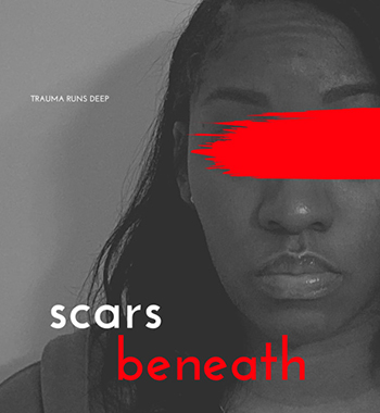 547380178 scars beneath poster Jaro Media